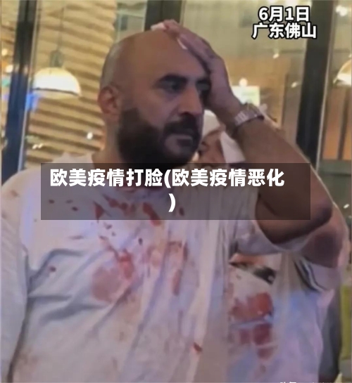 欧美疫情打脸(欧美疫情恶化)-第3张图片