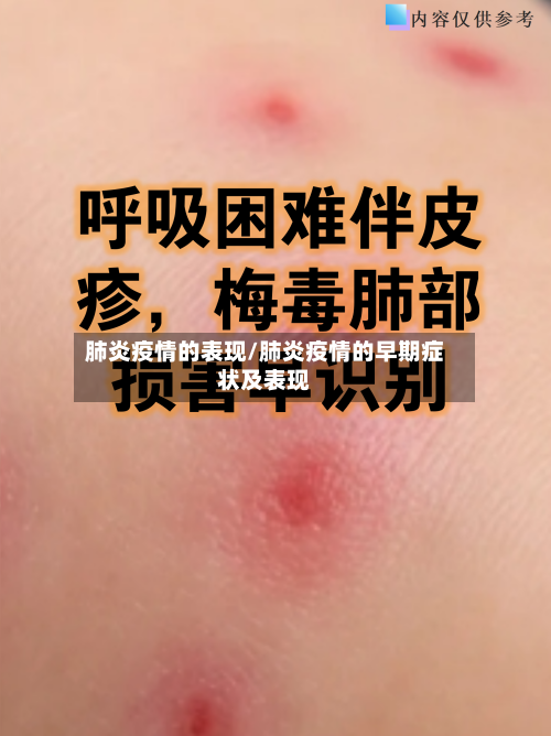 肺炎疫情的表现/肺炎疫情的早期症状及表现