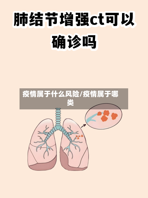 疫情属于什么风险/疫情属于哪类